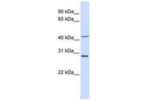 Image no. 1 for anti-Ribosomal Protein L3 (RPL3) (AA 36-85) antibody (ABIN6741022)