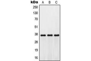 Western blot analysis of GPR171 expression in Jurkat (A), mouse kidney (B), H9C2 (C) whole cell lysates.