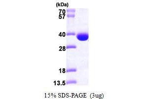 SDS-PAGE (SDS) image for Spermidine Synthase (SRM) (AA 1-302) protein (His tag) (ABIN667272)
