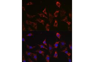 Immunofluorescence analysis of C6 cells using Bax Rabbit mAb  at dilution of 1:100 (40x lens).