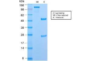 SDS-PAGE (SDS) image for anti-Protein tyrosine Phosphatase, Receptor Type, C (PTPRC) antibody (ABIN6940470)