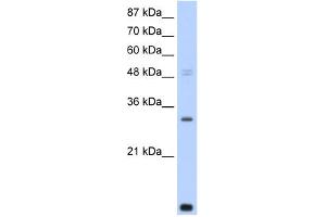 WB Suggested Anti-CNOT7 Antibody Titration:  0. (CNOT7 antibody  (N-Term))