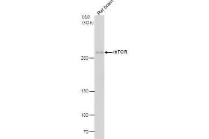 WB Image mTOR antibody [C1], Internal detects mTOR protein by western blot analysis. (MTOR antibody  (Internal Region))