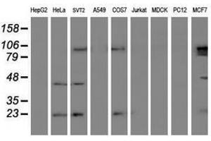 Image no. 2 for anti-Ubiquitin-Conjugating Enzyme E2E 3 (UBE2E3) antibody (ABIN1501616) (UBE2E3 antibody)