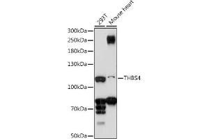 Western blot analysis of extracts of various cell lines, using THBS4 antibody (ABIN7270818) at 1:1000 dilution. (THBS4 antibody  (AA 27-300))