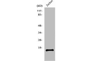 Western Blot analysis of Jurkat cells using PDGF-A Polyclonal Antibody (PDGFA antibody  (Internal Region))