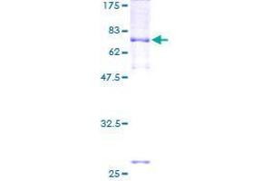 Image no. 1 for Transmembrane Channel-Like 6 (TMC6) (AA 1-444) protein (GST tag) (ABIN1322912) (TMC6 Protein (AA 1-444) (GST tag))