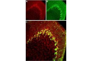 Expression of CaV3. (CACNA1H antibody  (Intracellular Loop))