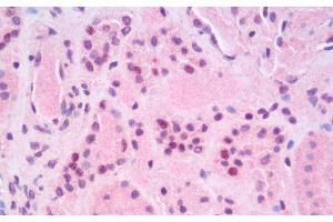 Immunohistochemistry analysis of paraffin-embedded Human Kidney using RELB Polyclonal Antibody. (RELB antibody)