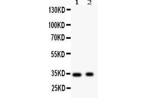 Anti- Synaptophysin Picoband antibody, Western blottingAll lanes: Anti Synaptophysin  at 0. (Synaptophysin antibody  (N-Term))