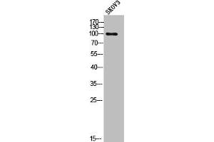 Western Blot analysis of SKOV3 cells using Phospho-EF-2 (T56) Polyclonal Antibody (EEF2 antibody  (pThr56))