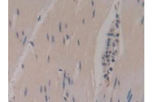 Detection of NSE in Human Rectum Tissue using Polyclonal Antibody to Enolase, Neuron Specific (NSE) (ENO2/NSE antibody  (AA 2-285))