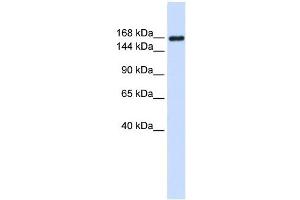 Laminin Gamma 1 antibody used at 1 ug/ml to detect target protein. (Laminin gamma 1 antibody)