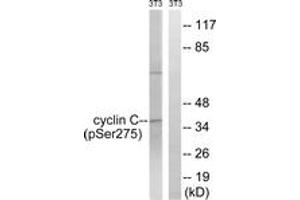 Western blot analysis of extracts from NIH-3T3 cells treated with UV 15', using Cyclin C (Phospho-Ser275) Antibody. (Cyclin C antibody  (pSer275))