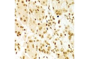 Immunohistochemistry of paraffin-embedded human stomach using DKC1 Antibody (ABIN5970956) at dilution of 1/100 (40x lens). (DKC1 antibody)