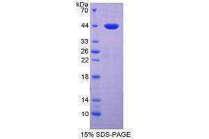 SDS-PAGE analysis of Rat Lipocalin 12 Protein. (LCN12 Protein)