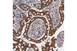 Immunohistochemical staining of human small intestine with ZNF780B polyclonal antibody  shows strong cytoplasmic and membranous positivity in glandular cells at 1:20-1:50 dilution.