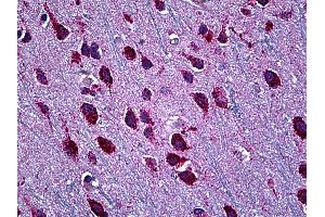 Immunohistochemistry (IHC) image for anti-SWI/SNF Related, Matrix Associated, Actin Dependent Regulator of Chromatin, Subfamily D, Member 2 (SMARCD2) (AA 398-475) antibody (ABIN626177)