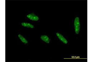 Immunofluorescence of purified MaxPab antibody to KLF15 on HepG2 cell. (KLF15 antibody  (AA 1-416))