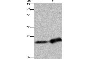 Western blot analysis of Human breast infiltrative duct and placenta tissue, using CSH1 Polyclonal Antibody at dilution of 1:300 (CSH1 antibody)