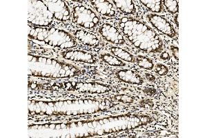 IHC analysis of DDX5 using anti-DDX5 antibody (ABIN7602561).