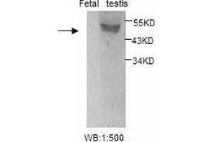 Image no. 1 for anti-Estrogen Receptor 2 (ESR2) antibody (ABIN790795) (ESR2 antibody)