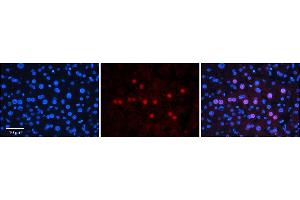 Rabbit Anti-GNL3L Antibody  Catalog Number: ARP58798_P050 Formalin Fixed Paraffin Embedded Tissue: Human Adult Liver  Observed Staining: Nuclear in hepatocytes, moderate signal, low tissue distribution Primary Antibody Concentration: 1:100 Secondary Antibody: Donkey anti-Rabbit-Cy3 Secondary Antibody Concentration: 1:200 Magnification: 20X Exposure Time: 0. (GNL3L antibody  (N-Term))