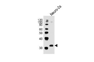 Anti-EN2Antibody (C-term)at 1:1000 dilution + Neuro-2a whole cell lysates Lysates/proteins at 20 μg per lane. (EN2 antibody  (C-Term))