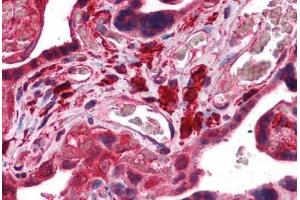 Human Placenta: Formalin-Fixed, Paraffin-Embedded (FFPE) (Fukutin antibody  (AA 272-456))