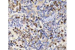 Immunohistochemistry of paraffin-embedded Rat spleen using UBASH3B Polyclonal Antibody at dilution of 1:100 (40x lens). (UBASH3B antibody)