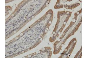 Image no. 3 for anti-Casein Kinase 1, gamma 1 (CSNK1G1) (AA 293-393) antibody (ABIN599256) (CSNK1G1 antibody  (AA 293-393))