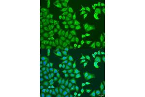 Immunofluorescence analysis of U2OS cells using CAPZB antibody. (CAPZB antibody  (AA 1-272))