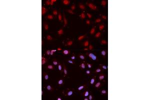 Immunofluorescence analysis of MCF7 cell using Phospho-CHEK1-S280 antibody. (CHEK1 antibody  (pSer280))