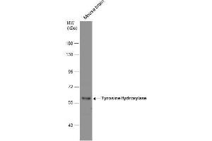 WB Image Mouse tissue extract (50 μg) was separated by 7. (Tyrosine Hydroxylase antibody)