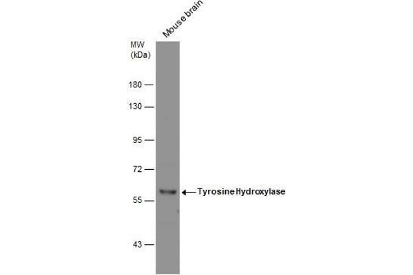Tyrosine Hydroxylase Antikörper