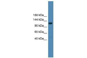 DGKQ antibody used at 0. (DGKQ antibody  (Middle Region))
