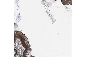Immunohistochemical staining of human colon with TRIP4 polyclonal antibody  shows cytoplasmic positivity in glandular cells. (TRIP4 antibody)