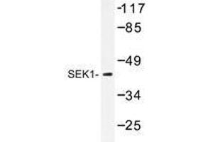 Western blot analysis of SEK1 antibody in extracts from 293 cells. (MAP2K4 antibody)