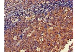 Immunohistochemistry of paraffin-embedded human tonsil tissue using ABIN7150570 at dilution of 1:100 (DOK3 antibody  (AA 1-146))
