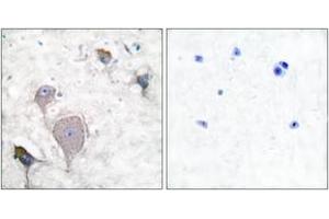 Immunohistochemistry analysis of paraffin-embedded human brain tissue, using Peripherin Antibody.