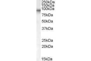 Image no. 1 for anti-Coagulation Factor XIII, A1 Polypeptide (F13A1) (AA 703-717), (Internal Region) antibody (ABIN374910) (F13A1 antibody  (Internal Region))