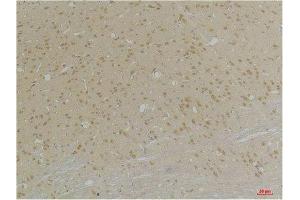 Immunohistochemistry (IHC) analysis of paraffin-embedded Rat Brain Tissue using GABA A Receptor alpha4 Rabbit Polyclonal Antibody diluted at 1:200. (GABRA4 antibody)