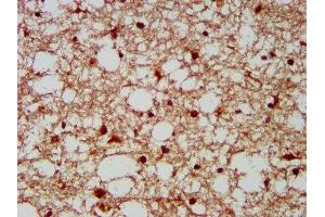 IHC image of ABIN7155695 diluted at 1:300 and staining in paraffin-embedded human brain tissue performed on a Leica BondTM system. (GBX2 antibody  (AA 65-248))