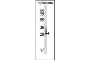 Western blot analysis of DNAJC27 / RBJ Antibody (N-term) in human placenta tissue lysates (35ug/lane). (DNAJC27 antibody  (N-Term))