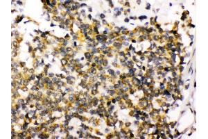 Immunohistochemistry (Paraffin-embedded Sections) (IHC (p)) image for anti-Discs, Large Homolog 4 (Drosophila) (DLG4) (AA 581-724) antibody (ABIN3043563) (DLG4 antibody  (AA 581-724))