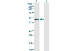 Western Blot analysis of PHKG2 expression in transfected 293T cell line by PHKG2 monoclonal antibody (M05), clone 2B8. (PHKG2 antibody  (AA 1-406))