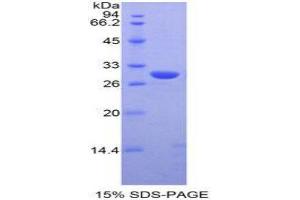 SDS-PAGE (SDS) image for Moesin (MSN) (AA 354-577) protein (His tag) (ABIN2125935)