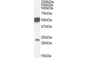 Western Blotting (WB) image for anti-Neurturin (NRTN) (C-Term) antibody (ABIN2466008) (Neurturin antibody  (C-Term))