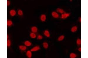 ABIN6268961 staining NIH-3T3 by IF/ICC. (Cyclin C antibody  (C-Term))