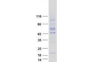 Validation with Western Blot (YPEL4 Protein (Myc-DYKDDDDK Tag))